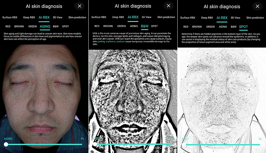 Varför använder fler och fler estetiska centra Skin Analyzer?
